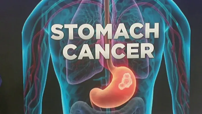 Stomach Cancer Awareness Month