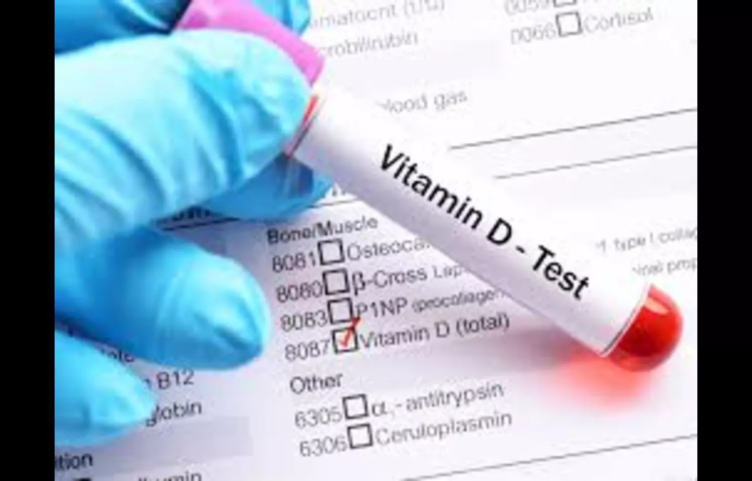 Low Vitamin D Levels Linked to Increased Risk of chronic hepatitis: Study