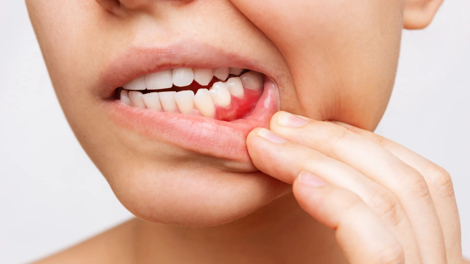 Dentists reveal the worst foods for gum inflammation - and how to future-proof your smile