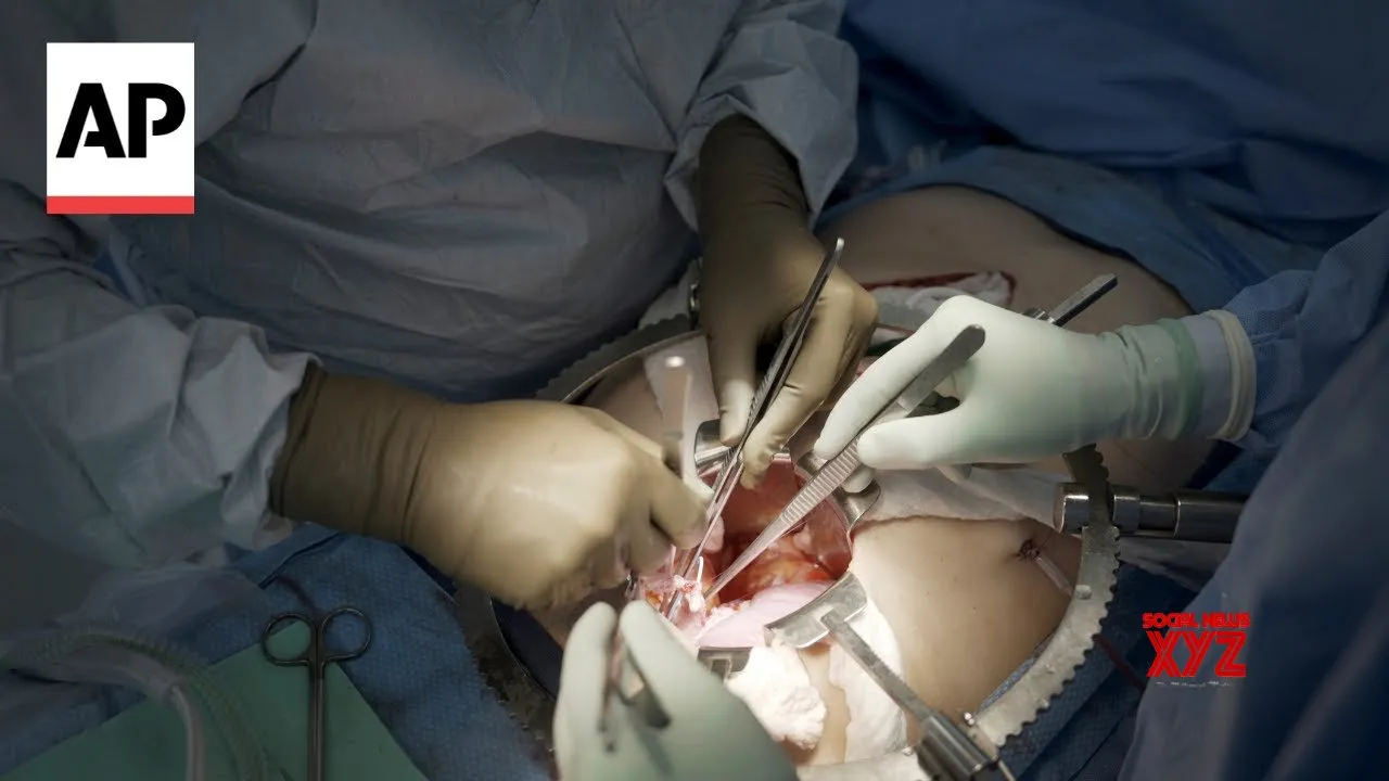 First clinical trial of pig kidney transplants is underway (Video)
