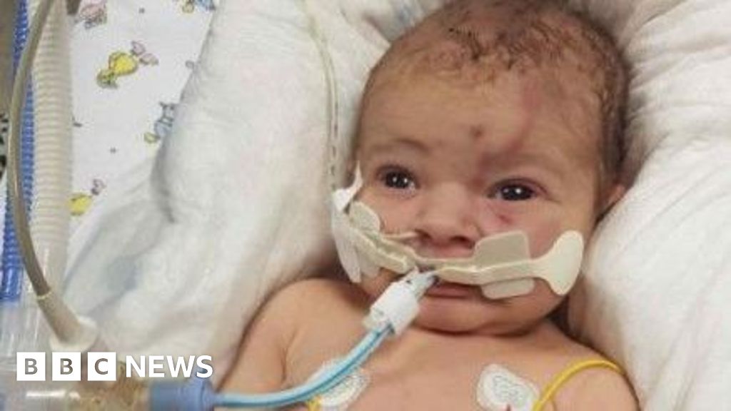 Maternity inquiry must include care culture - dad