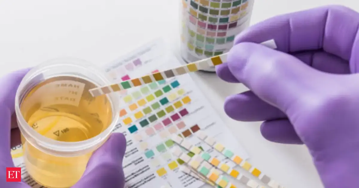 Doctors reveal the perfect daily water intake to flush uric acid and protect kidneys