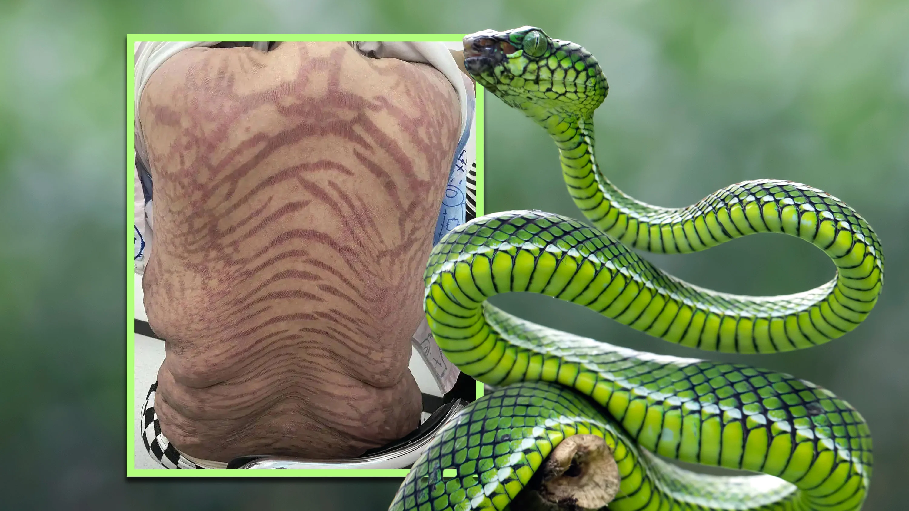 China woman develops snake-like patterns on body from using ‘pure TCM’ ointment