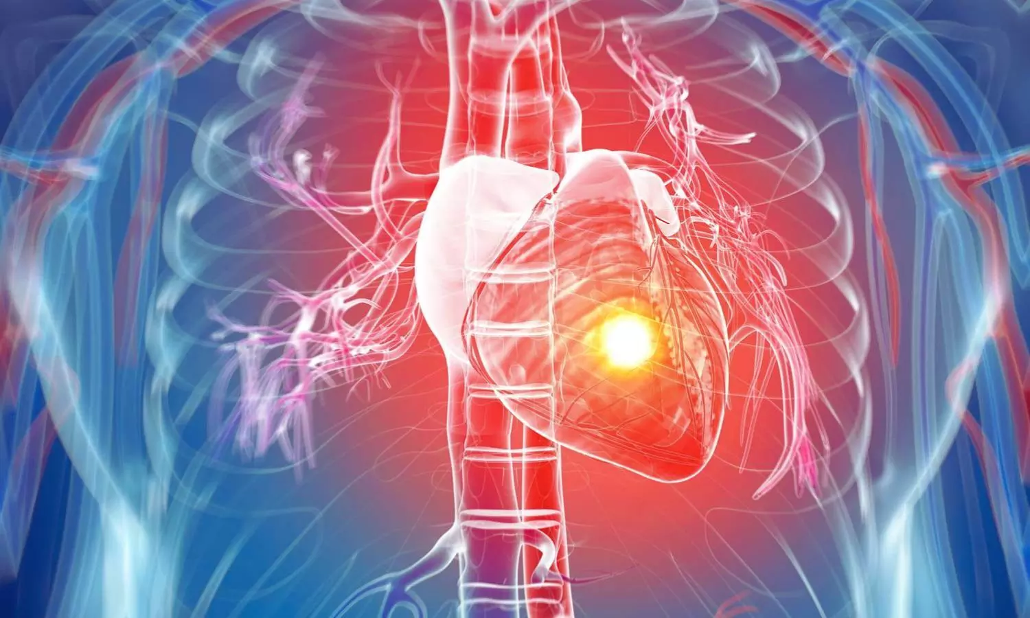 Silent Heart Attacks Pose Long-Term Health Risks for Men Than Women: Study