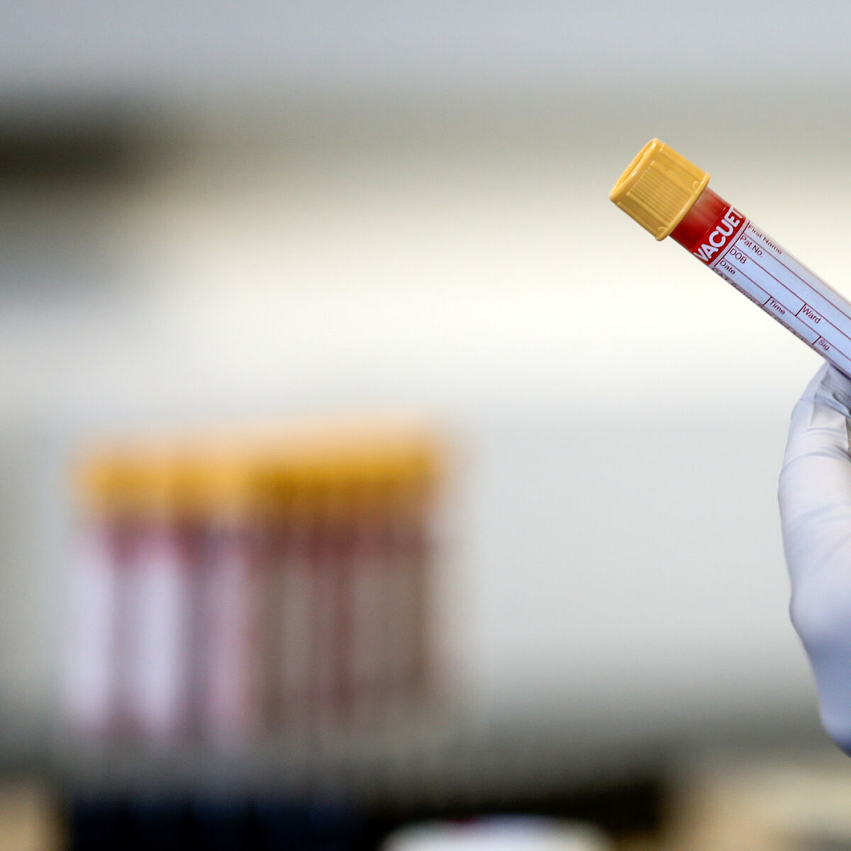 Cork to get new mural to tackle 'outdated ideas' and stigma around living with HIV