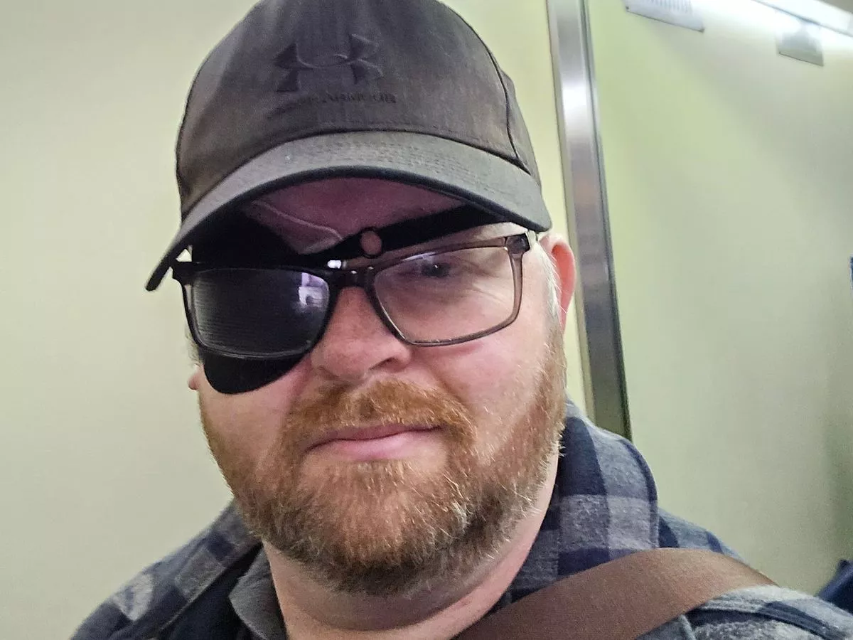 Bloke felt like 'teen again' after rare condition left him with 'boob hallucinations'