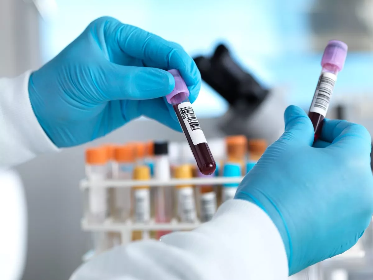 Simple blood test in middle age predicts dementia 25 years early