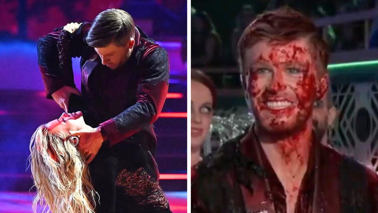 Aus star shocks with face full of blood