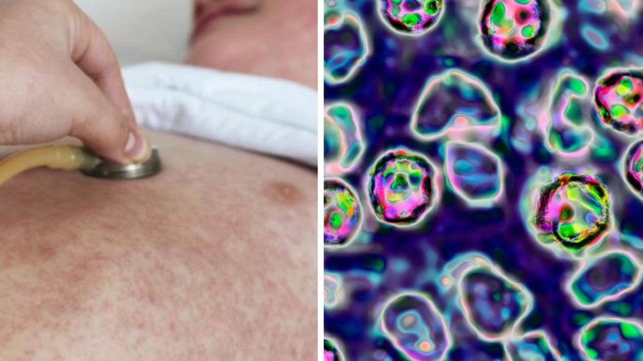 Warning as deadly disease outbreak grows