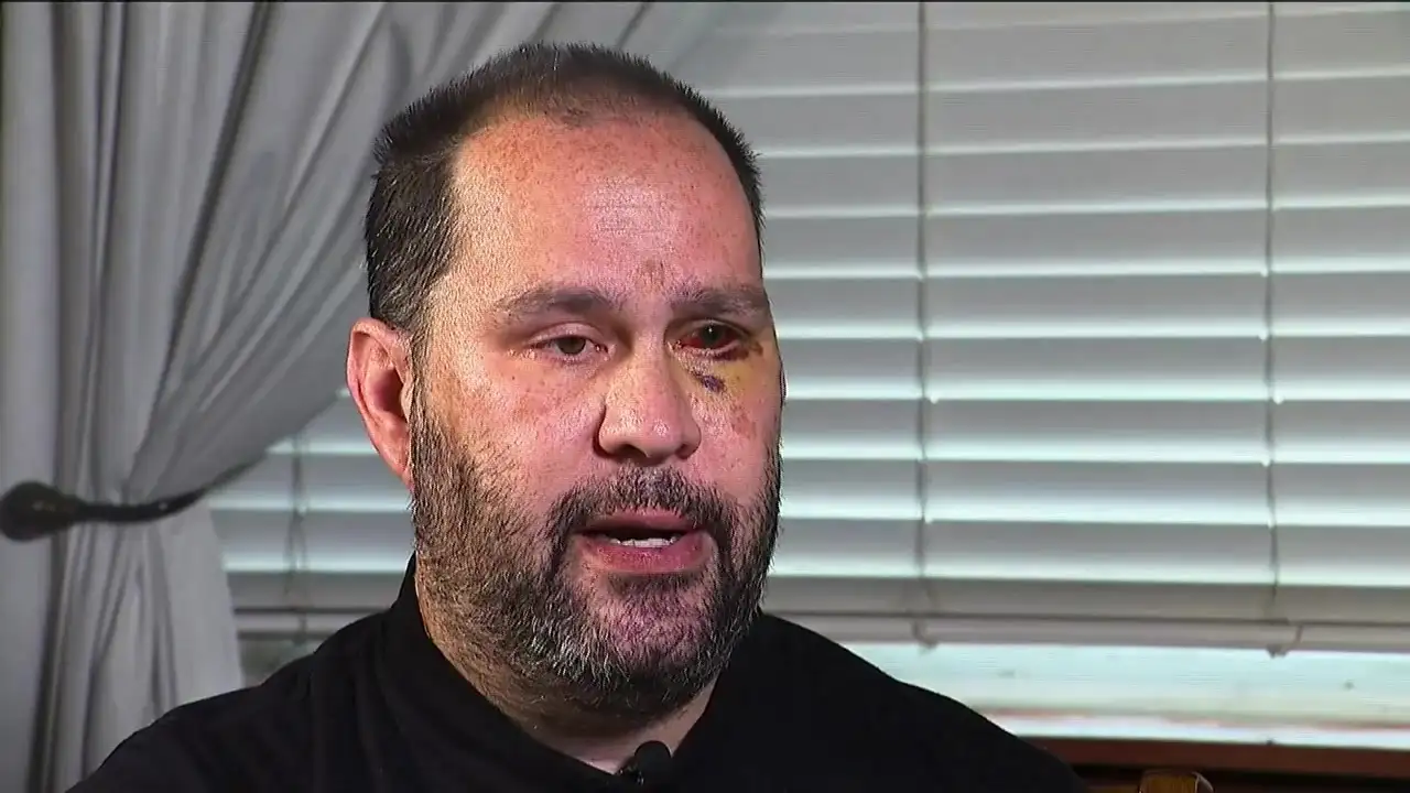 ‘I should not be here talking to you today’: Former Fall River mayor speaks after random act of violence