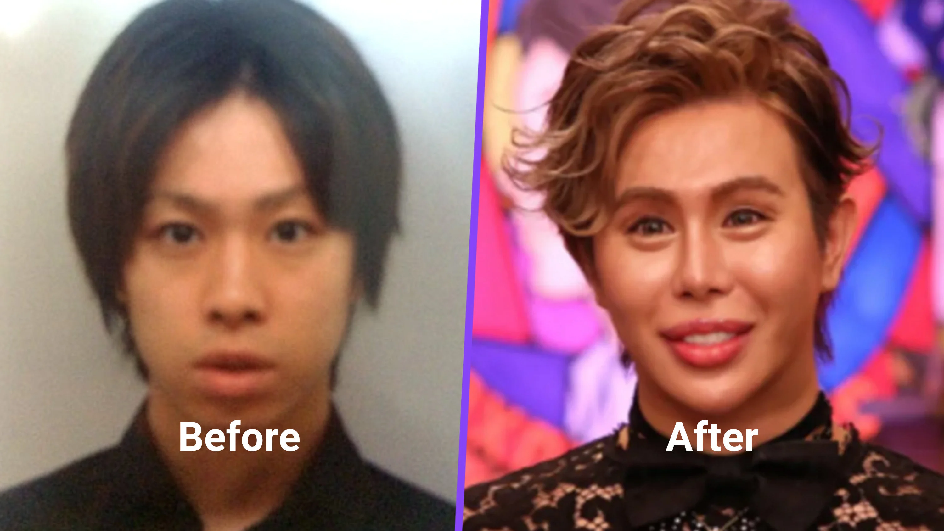 Japan bullying victim becomes ‘world’s most beautiful’ after US$650,000 plastic surgery
