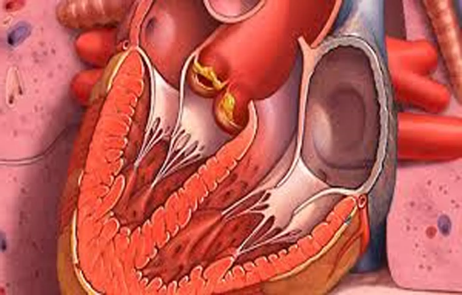 Female Patients with Culture-Negative Endocarditis Face Worse Prognosis, suggests study