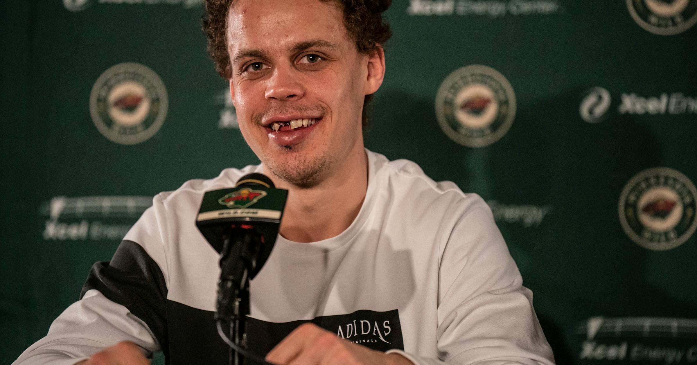 Losing teeth is common in hockey; what happens after that?