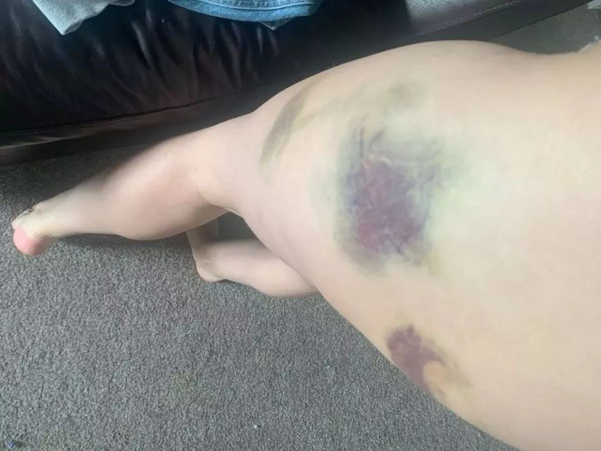 Woman beaten by ex-partner has 'no faith' in system after waiting years for justice