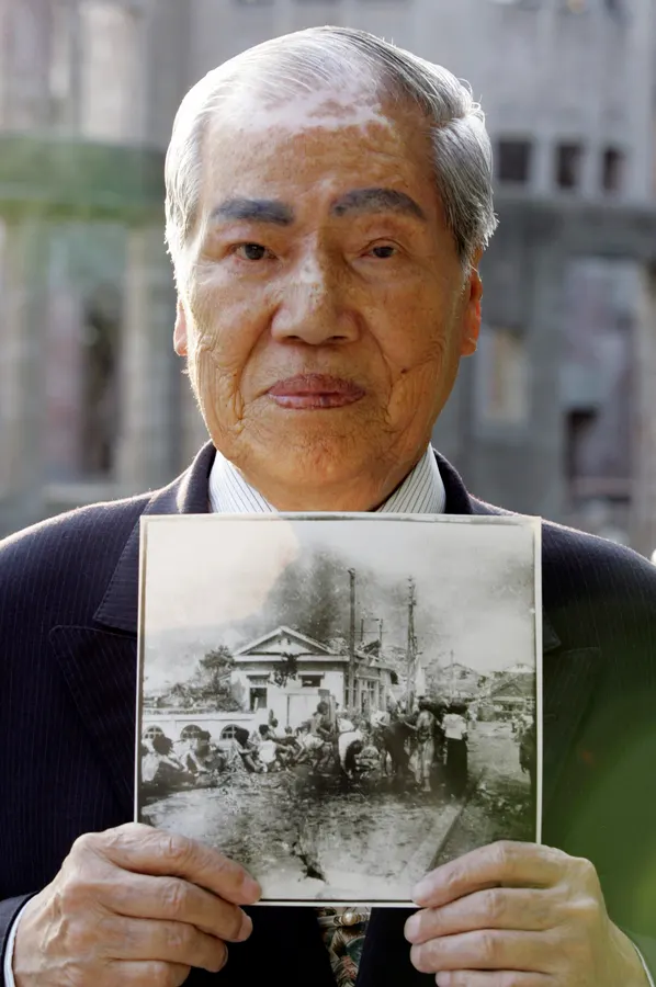 What Lifelong Study Of Atom Bomb Survivors Tells Us About Radiation