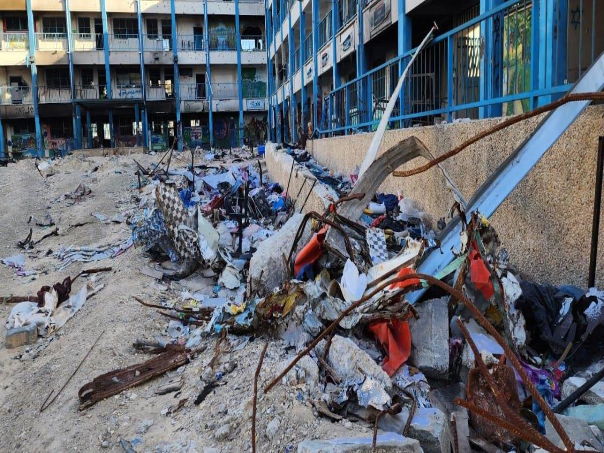 Palestinian Ministry of Health: Gaza Has Highest Rate of Limb Amputations Among Children