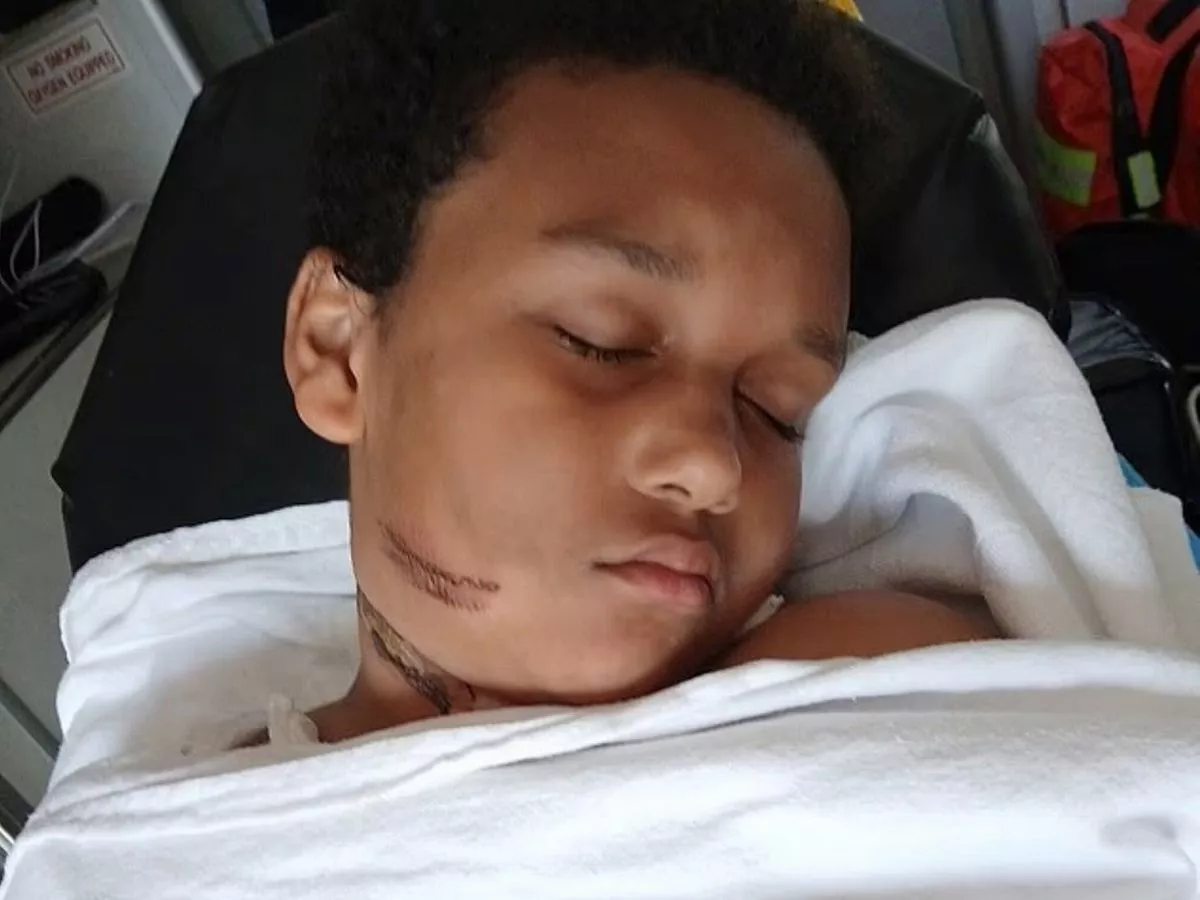 Boy, 9, recalls horror moment he almost died after charger caught fire  in bed
