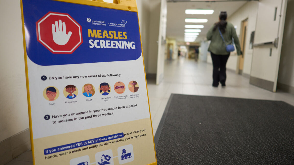 Canada fought measles and measles won; virus now endemic after 1998 elimination