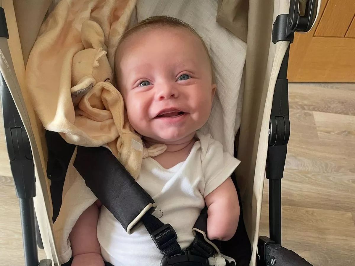 Baby boy born with rare condition that left mum fearing the worst