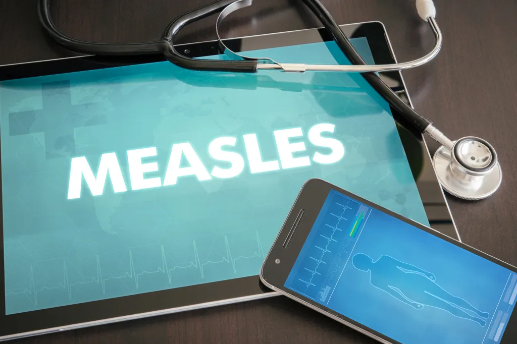 Philadelphia airport passengers may have been exposed to measles