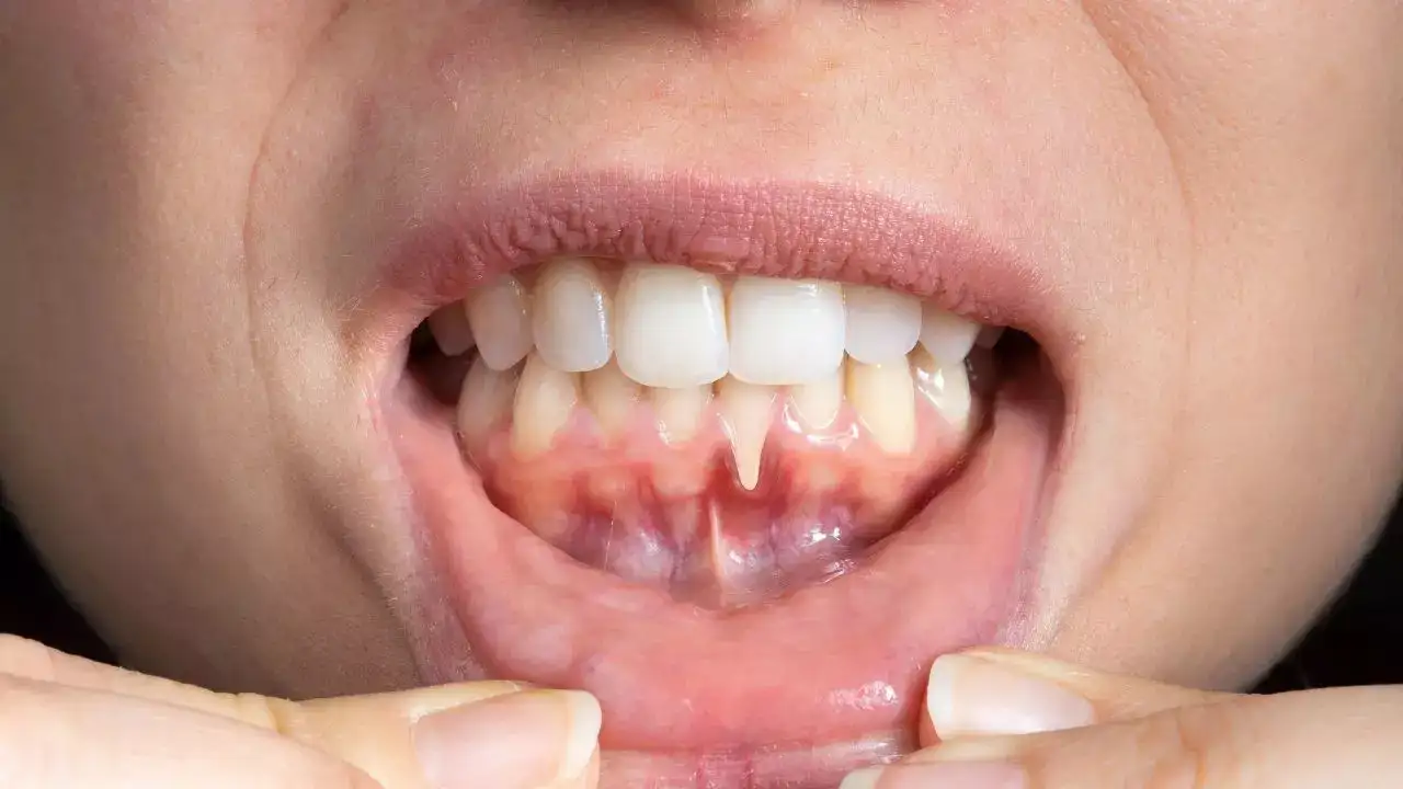 8 health problems that show up in your teeth and gums: What your smile reveals about your wellness