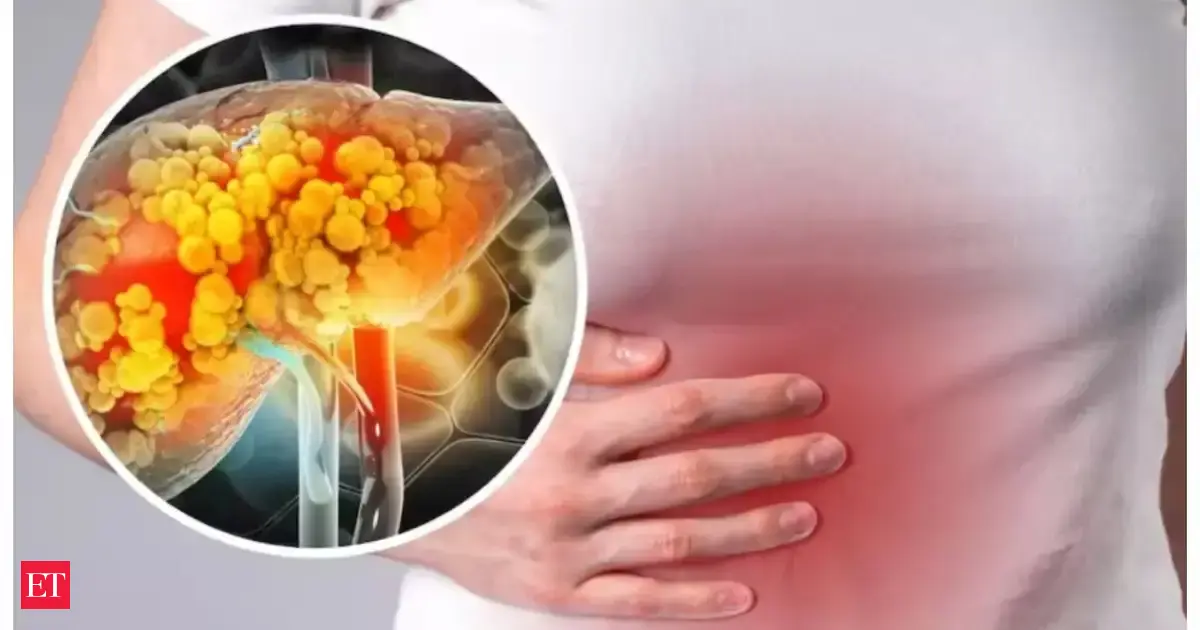 Essential tips to prevent fatty liver: Foods to avoid and lifestyle changes for better liver health